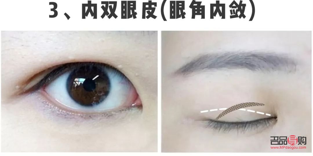 什么樣的雙眼皮才好看(什么樣的雙眼皮才好看圖片)