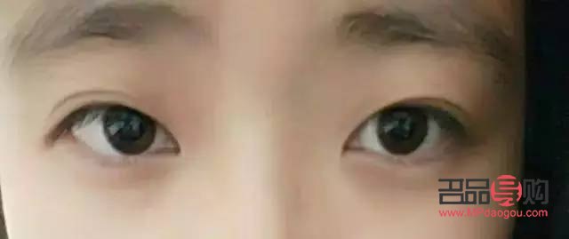 什么樣的雙眼皮才好看(什么樣的雙眼皮才好看圖片)