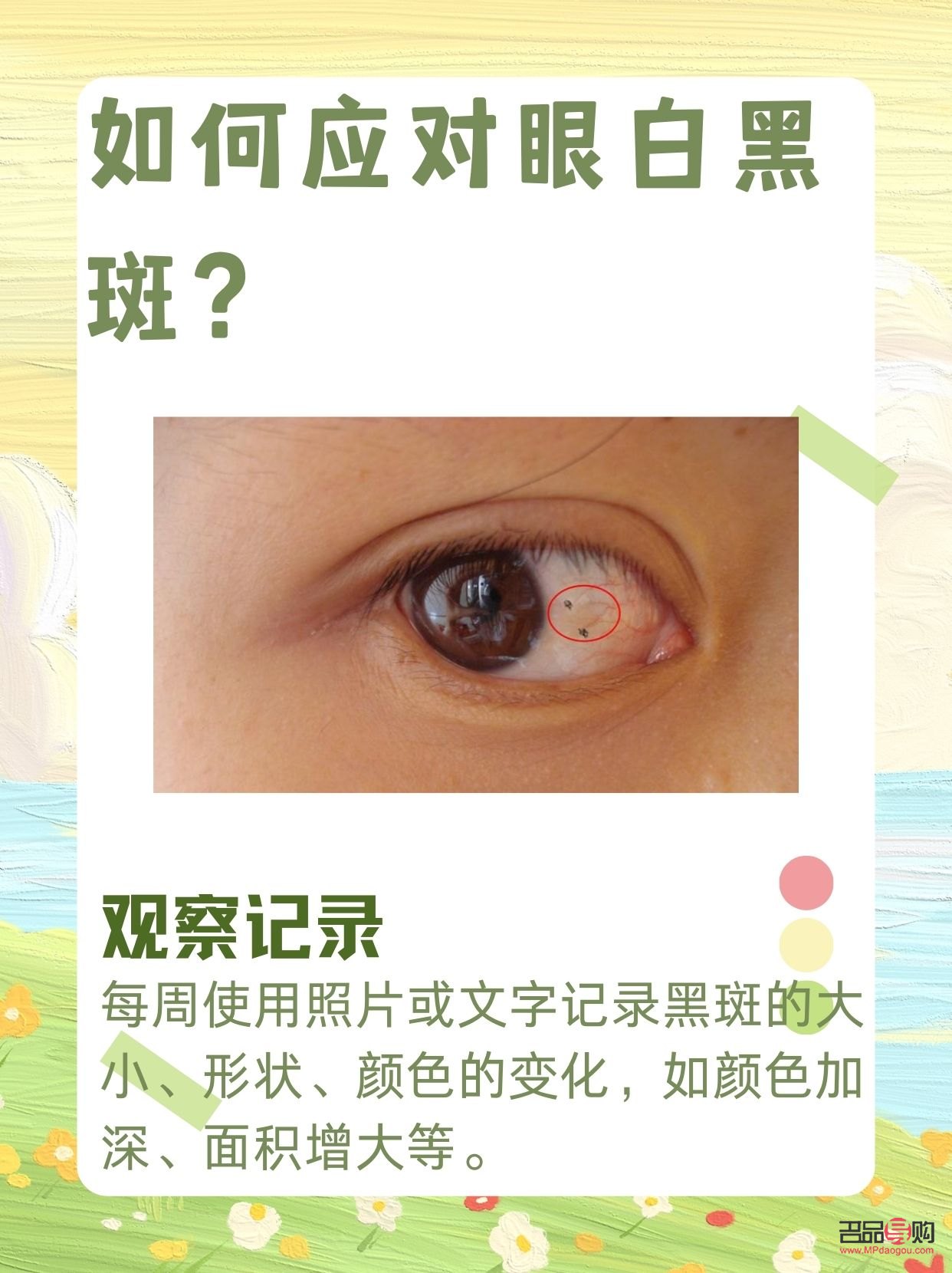 眼睛白色部分有黑色斑塊(兒童眼睛白色部分有黑色斑塊)