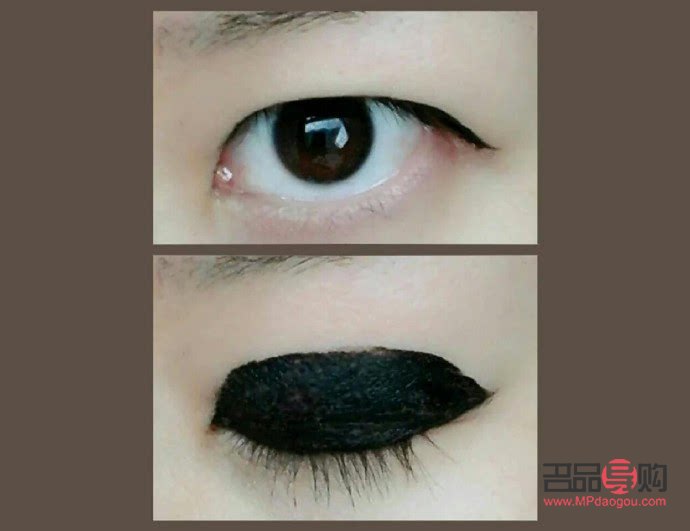 <h3>雙眼皮手術(shù)失敗類型詳解</h3>