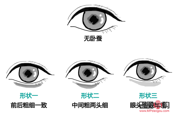 何為臥蠶眼(什么叫臥蠶眼睛)