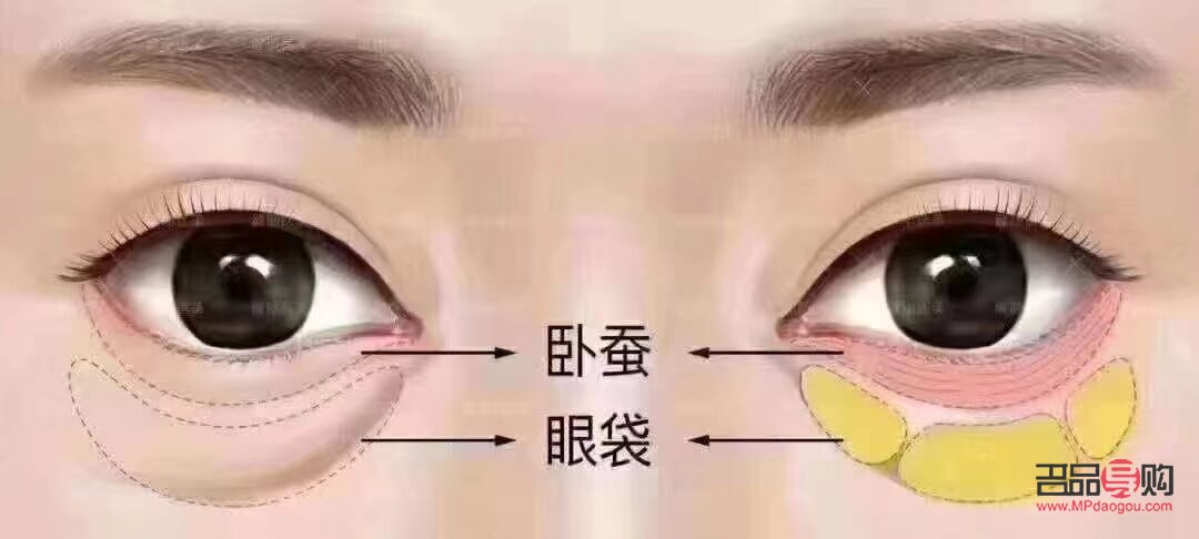 何為臥蠶眼(什么叫臥蠶眼睛)