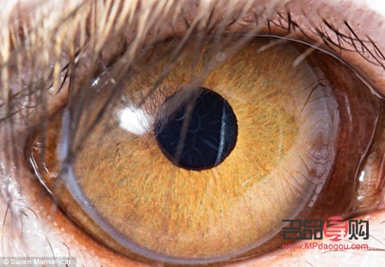 <h3>眼睛增生處理方法大揭秘</h3>