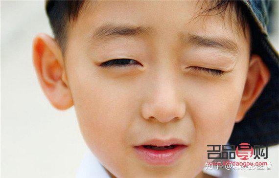 小孩眼睛老是斜瞟(孩子眼睛時不時斜瞟一下)