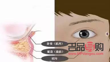 脂肪型眼袋怎么形成的(脂肪型眼袋怎么形成的)
