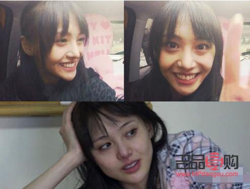 割眼袋外切好還是內(nèi)切好視頻(割眼袋外切好還是內(nèi)切好視頻教程)