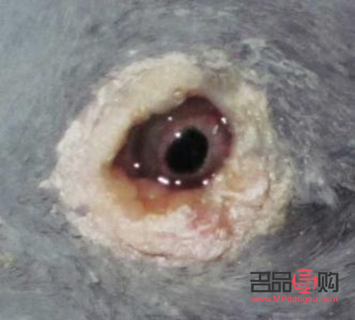 單眼腫脹原因解析