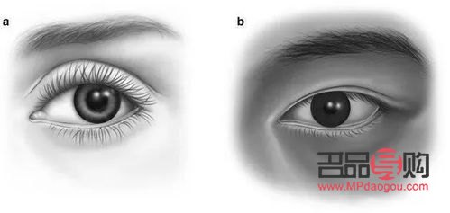 <h3>眼窩凹陷的成因及解析</h3>