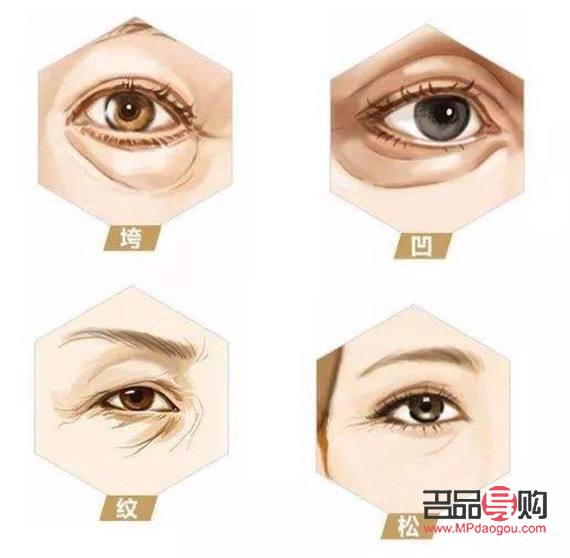 <h3>眼窩凹陷的成因及解析</h3>