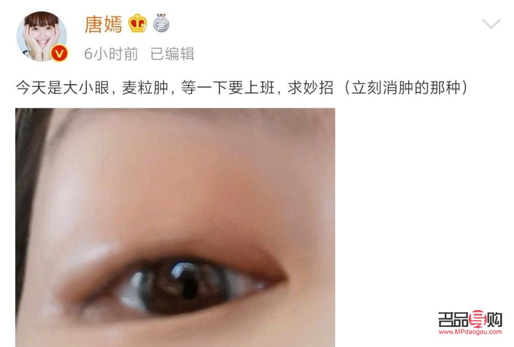 小眼綜合一般需要多少錢(小眼綜合一般需要多少錢一次)