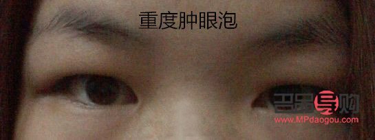 <h3>女人腫眼泡，福氣之象征？</h3>