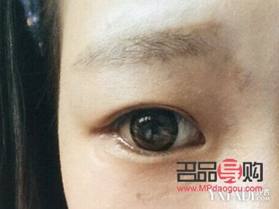 <h3>女人腫眼泡，福氣之象征？</h3>