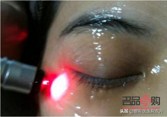 美容祛斑會反彈嗎(激光美容祛斑會反彈嗎)