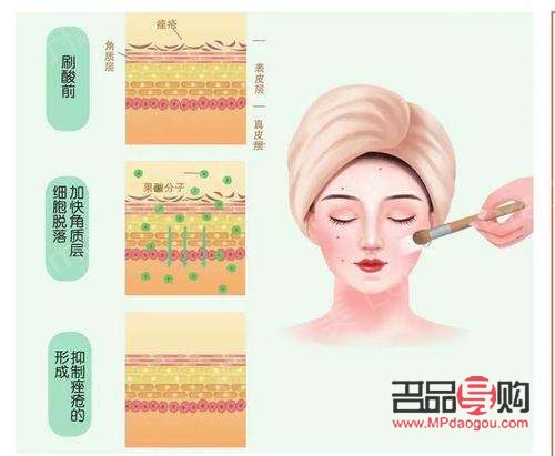 身體刷酸冬天怎么護(hù)理(身體刷酸冬天怎么護(hù)理皮膚)