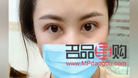 平扇雙眼皮洋氣嗎(平扇雙眼皮洋氣嗎)