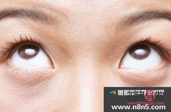 上眼皮下垂鍛煉方法(上眼皮下垂鍛煉方法圖解)