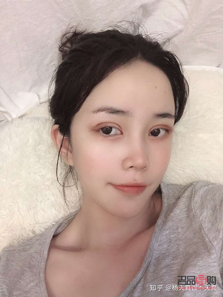 探索雙眼皮手術(shù)：哪種雙眼皮最自然、最好看？