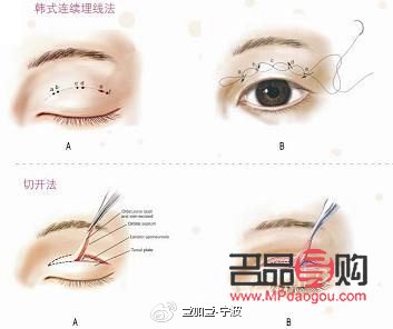 雙眼皮美學(xué)：探尋最洋氣的雙眼皮風(fēng)格