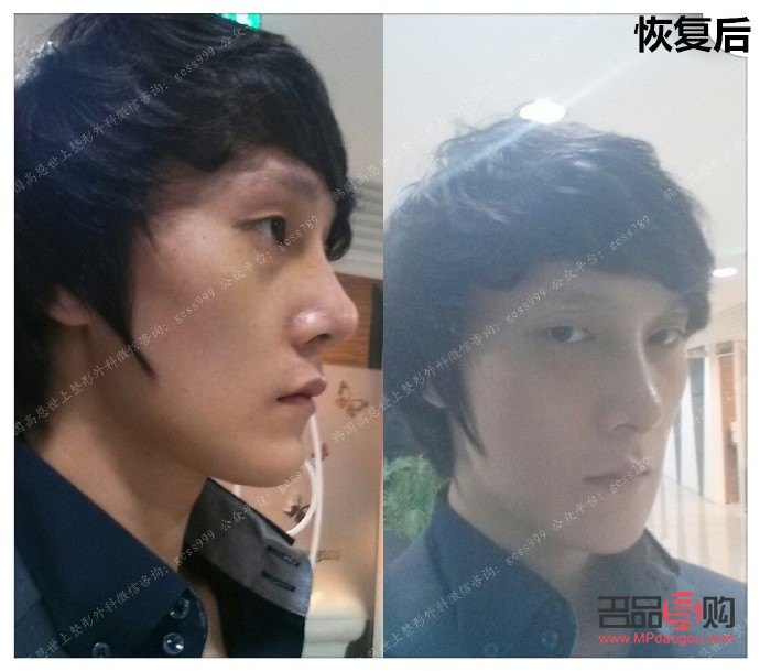 在哪個整形美容好(哪個整形美容醫(yī)院好)