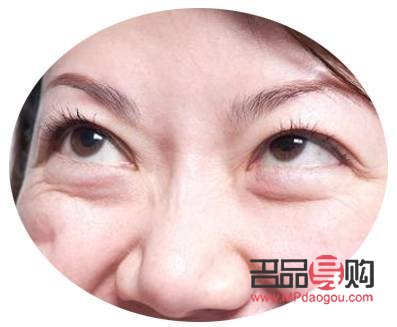 眼袋什么年齡去除最好(眼袋什么年齡去除最好圖片)