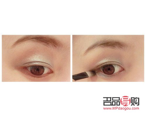 大眼綜合真實恢復(fù)期圖片(大眼綜合的恢復(fù)過程)