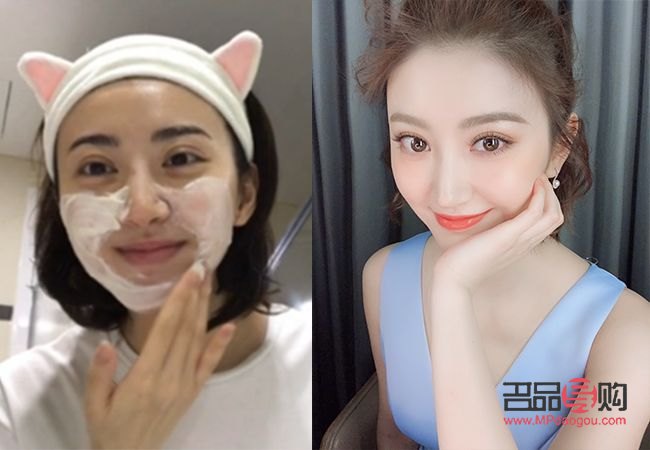 <h3>雙眼皮二次手術(shù)：需求、風險與考量</h3>