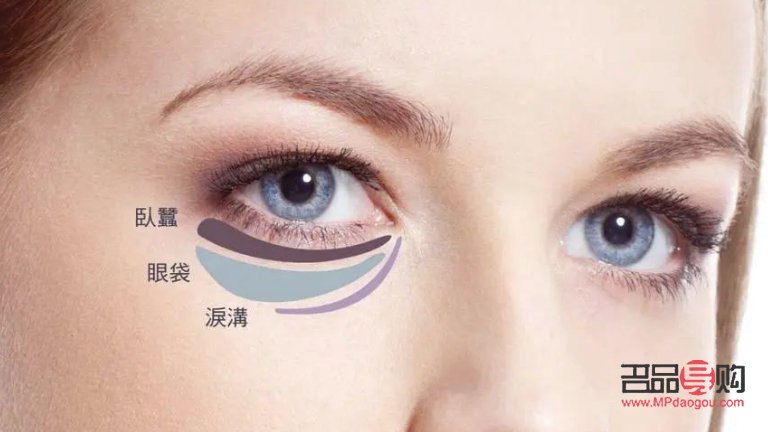 <h3>探究眼袋形成之謎：成因、影響與解決方案</h3>
