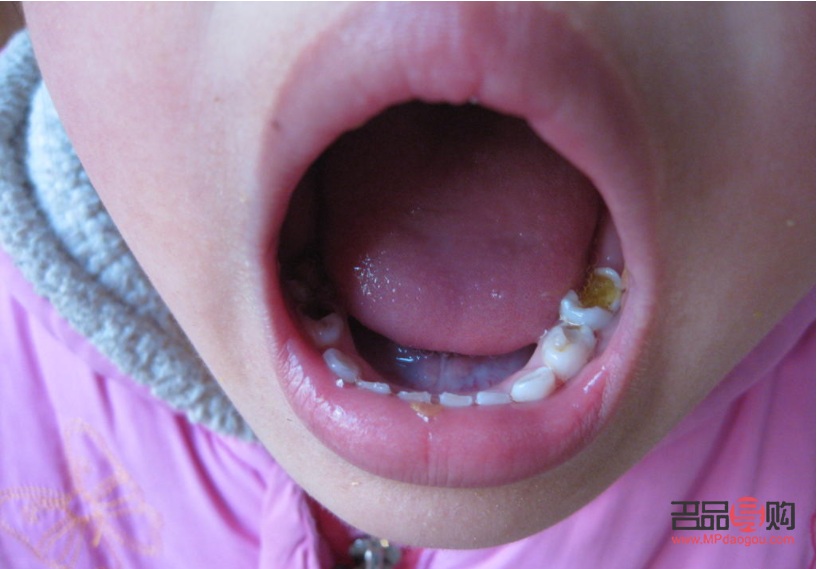 為什么要重視身體護理(為什么要重視身體護理工作)