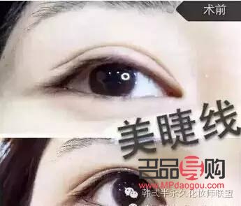 <h3>內(nèi)雙紋眼線與美瞳線，哪個更具魅力？</h3>