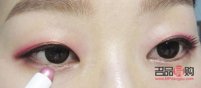 <h3>內(nèi)眼角開(kāi)太大如何進(jìn)行有效修復(fù)</h3>