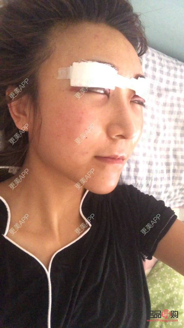 <h3>西安市雙眼皮整形優(yōu)選之地</h3>