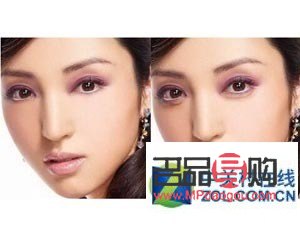 <h3>男士去眼袋最佳策略：告別疲憊，重拾青春魅力</h3>