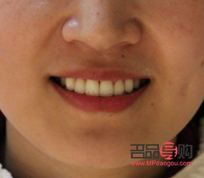 <h1>牙齒美容：綻放自信笑容的秘密武器</h1>