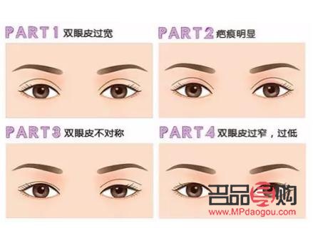 <h3>雙眼皮眼形分類大全，你屬于哪一種？</h3>