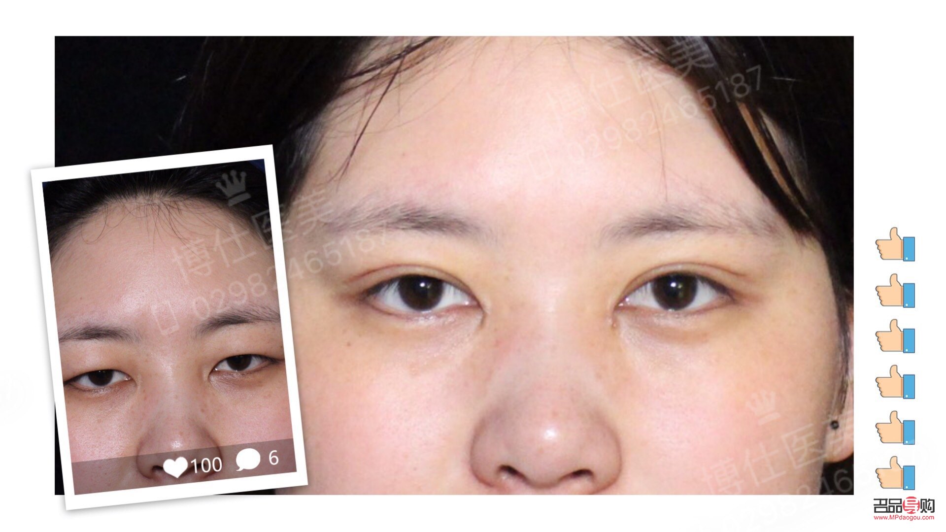 <h3>開(kāi)扇雙眼皮是什么意思？</h3>