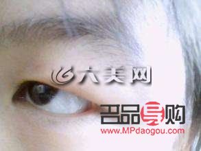 <h3>消除腫眼泡的有效非手術(shù)方法</h3>