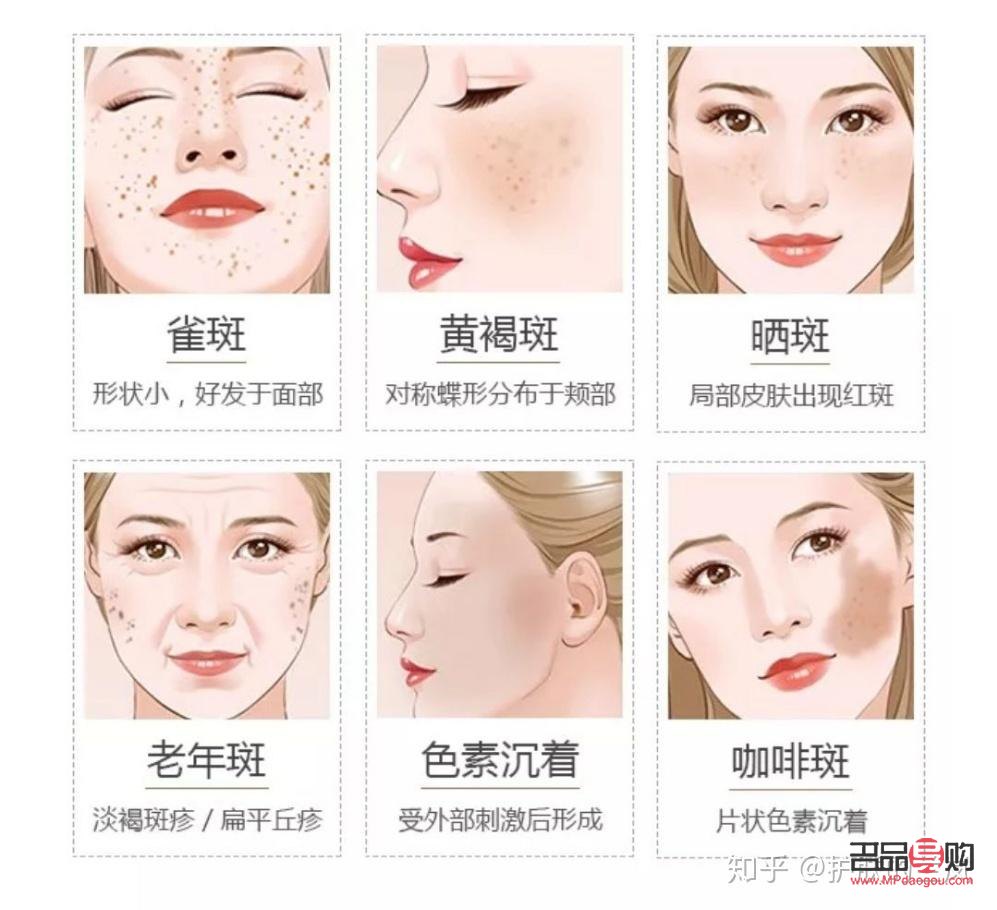 美容祛斑好嗎(美容祛斑好嗎知乎)