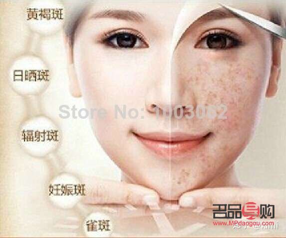 美容祛斑好嗎(美容祛斑好嗎知乎)