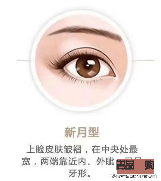 新月型雙眼皮與平扇形雙眼皮的區(qū)別