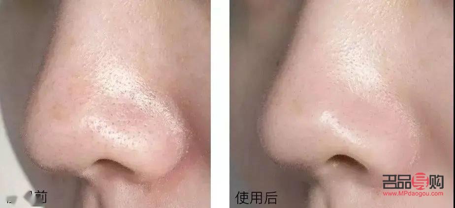 <h3>眼部保養(yǎng)手法：呵護明眸，告別歲月痕跡</h3>