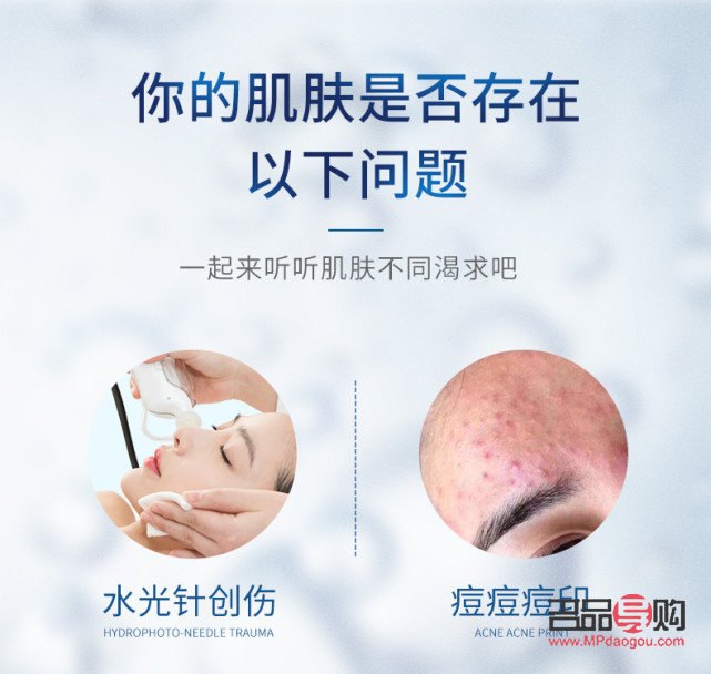 醫(yī)療美容祛痘全攻略：告別痘痘，重拾無瑕肌膚