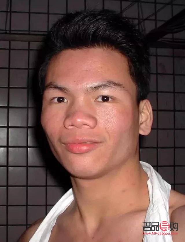 眼睛凸起可以恢復(fù)嗎？專業(yè)解析與恢復(fù)方法探討