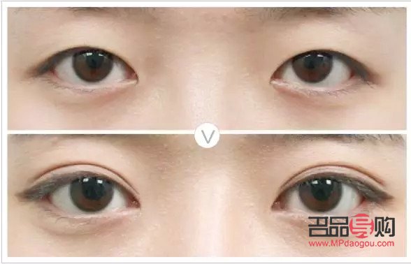 單眼皮與內(nèi)雙眼皮對照圖(單眼皮與內(nèi)雙眼皮對照圖片)