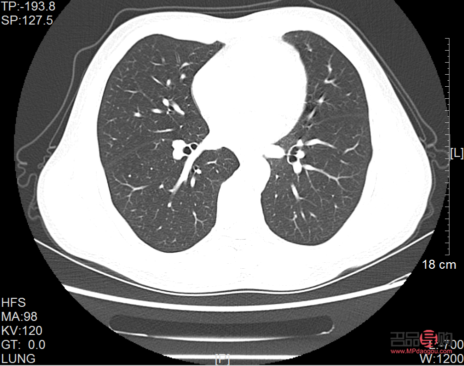 去黑眼圈的土方法(去黑眼圈的土方法黑眼圈嚴重去檢查掛什么科)