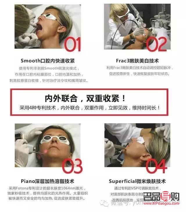 fotona眼部抗衰299套餐(fotona和超聲炮的區(qū)別)