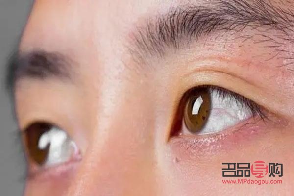 眼睛陷進去了怎么回事(眼睛陷進去了怎么回事兒)