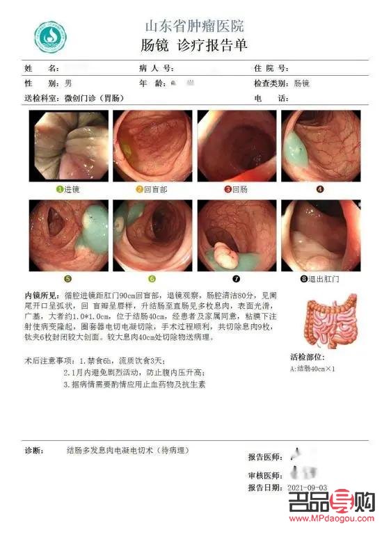 美容院割息肉疼嗎——專業(yè)解讀疼痛感受與緩解方法