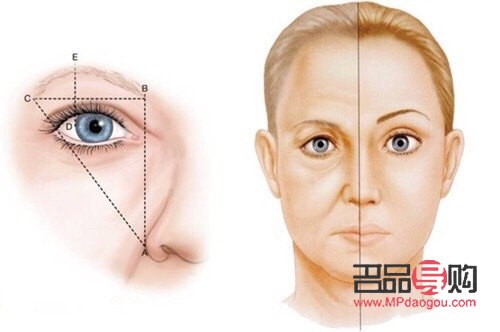 <h3>眼尾下垂圖片：解讀眼部衰老跡象及改善方法</h3>