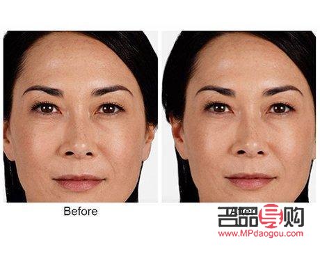 眼尾下垂圖片：解讀眼部衰老跡象及改善方法