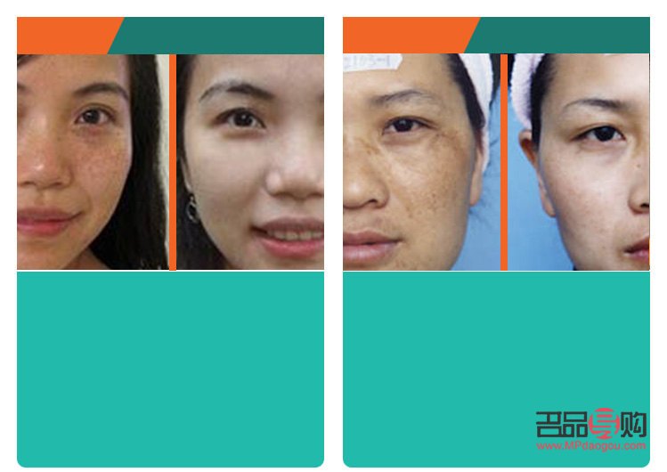 <h3>哪個(gè)美容院祛斑好？專業(yè)祛斑，重拾肌膚光彩</h3>